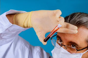 Doctor holding test tube with blood plasma for testing