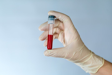 Test tube with a blood sample in the hands of a nurse. Blood test for viruses in the clinic with the observance of precautions.