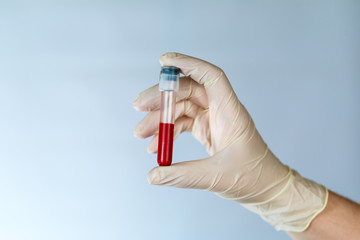 Test tube with a blood sample in the hands of a nurse. Blood test for viruses in the clinic with the observance of precautions.