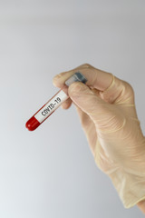 Obraz premium Laboratory sample of blood testing for diagnosis new Corona virus infection (COVID-19) from Wuhan, China. Pandemic infectious concept.