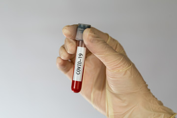Laboratory sample of blood testing for diagnosis new Corona virus infection (COVID-19) from Wuhan,...