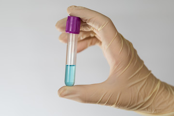 Test tube with blue transparent chemical fluid in the hands of a scientist. Hands in latex gloves. Vacuum test tube.