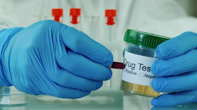 Analysis of urine with a positive result on doping, the lab technician makes a mark in pencil