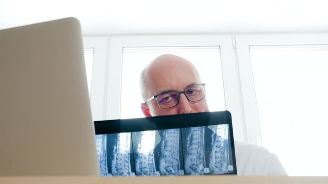 Thinking doctor looking x-ray of backbones and scratching head. Pensive surgeon watching spine bones front computer screen. Medical worker in white medical gown holding x-ray in hospital office