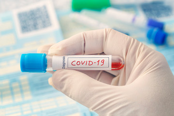 Coronavirus 2019-nCoV Blood Sample. New Epidemic Corona Virus. Corona virus outbreaking. Corona...