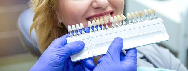 teeth palette with different shades of teeth near female smiling. Stomatology, whitening teeth, tooth implant