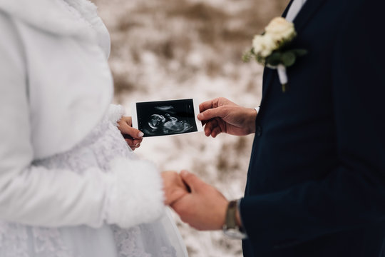 Man holding woman's hand and in other hand, together holding ultrasound image with their, yet unborn, child. Newlyweds have typical wedding attire. Focus on image, background/foreground out of focus.