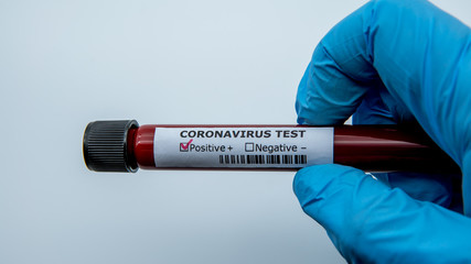 Obraz premium Surgical gloves with a positive coronavirus infected blood sample test.