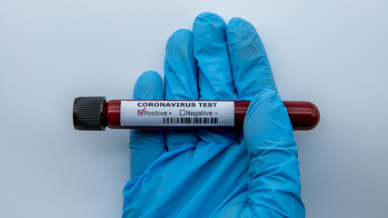 Obraz premium Test tube with infected blood sample for COVID-19, coronavirus from Wuhan