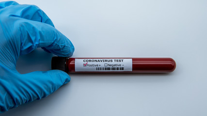 Obraz premium Laboratory technician hand hold blood sample tube for corona virus test