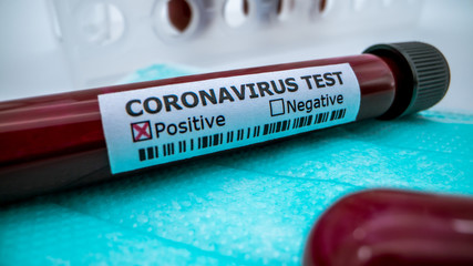 Protective mask and positive COVID-19 test. Laboratory sample of blood