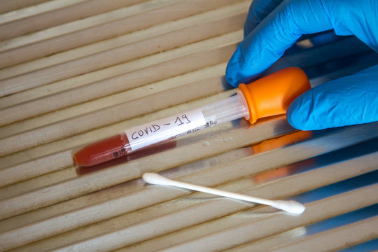 doctor with blue glove preparing to use a   cotton swab and codiv 19 test tube with blood