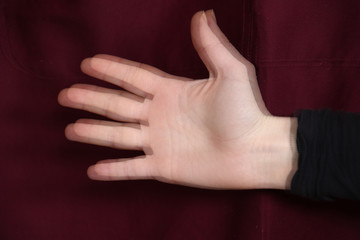 Parkinsonian and tremor is an involuntary quivering movement and a tyical Parkinson's disease...