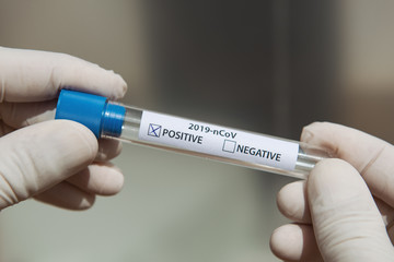 Obraz premium Soft focus hands of a lab technician with test tube. Positive result.