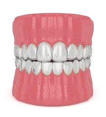 3d render of jaw with invisalign removable retainers
