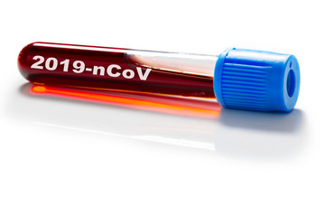 Blood sample, coronavirus, tubes with blood are examined for corona