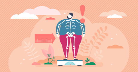 Overweight concept, flat tiny person vector illustration - obrazy, fototapety, plakaty