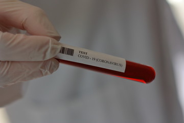 Obraz premium TEST CORONAVIRUS DE WUHAN (COVID -19) 