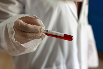TEST CORONAVIRUS DE WUHAN (COVID -19) 