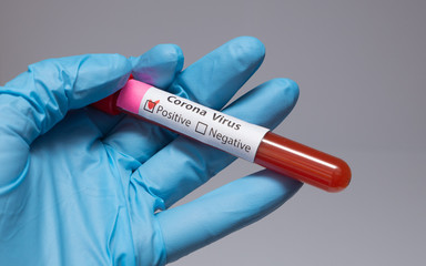 Obraz premium Blood positive test to coronavirus. Medical reseach, test-tube with blood, hand in latex medical gloves. Coronavirus outbreak and influenza. 2019-nCoV, covid-19, sars. High quality photo. 