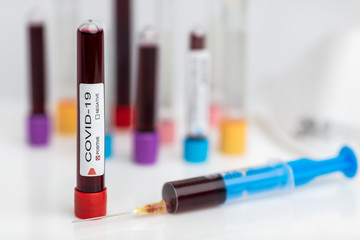 Laboratory sample of the novel Coronavirus