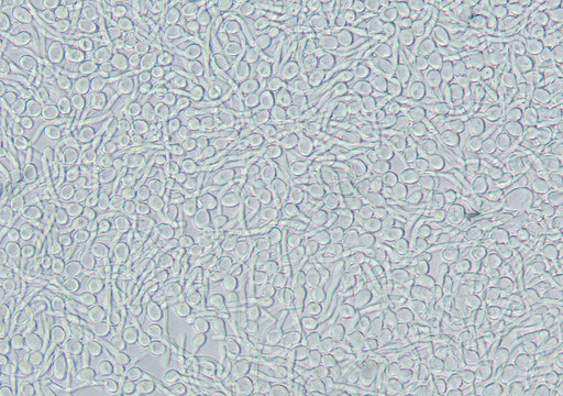 Yeast Biofilm