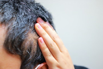 薄毛で悩む白髪交じりの頭皮