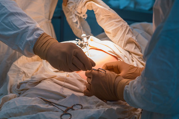close-up hands of pediatric surgeons perform surgery using laparoscopic ports for endoscopic...