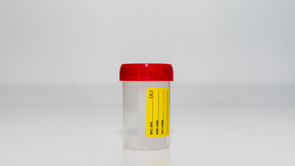 Urine Sample Container