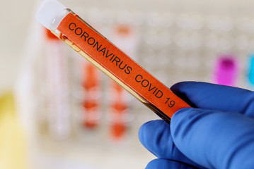 Obraz premium Tube infected blood sample in hand with Covid 19 coronavirus
