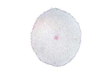 Dicot root cross section slide view under microscope for botany education.