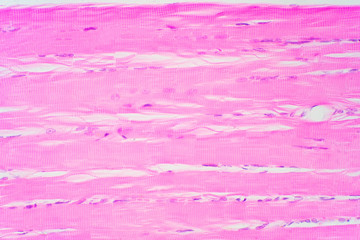 Human skeletal muscle under microscope view for education pathology.