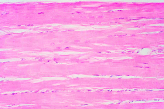 Human skeletal muscle under microscope view for education pathology.
