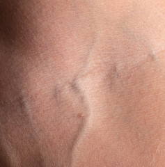 veins on a male hand as a background