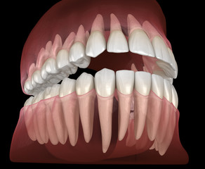 Morphology of human teeth. Medically accurate tooth 3D illustration