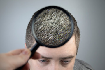 A trichologist examines a young man’s gray hair under a magnifying glass. Earlier bleaching of...