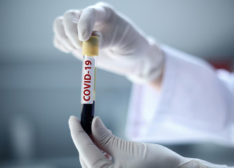 Doctor's hands holding a test tube with a sample contaminated by Coronavirus with label Covid-19