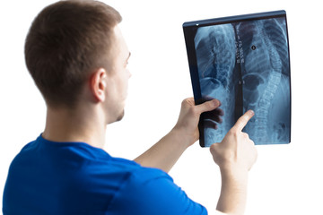 The doctor examines the x-ray image of the spine.The doctor is holding a photo of fluorography on a white background