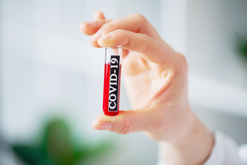 Health worker holds a test tube with a test of covid-2019