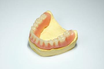 Dental prosthesis