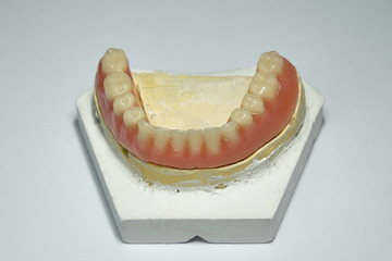 Dental prosthesis