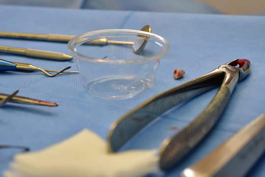 Extracted teeth on surgical surface