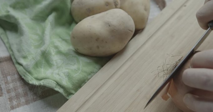 tagliere con cipolle preparazione soffritto