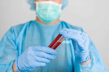 Blood test tubes in medicine hands