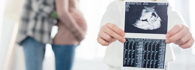 Cropped view of child holding ultrasound scan of baby while woman embracing pregnant girlfriend at...
