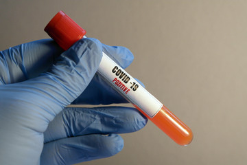 Fototapeta premium Coronavirus 2019-nCoV Blood Sample. Testing positive to covid-19. Corona Virus in Lab. Scientist hold tube with Blood Test with the Virus Name Coronavirus. Reaching europe, killing in Italy