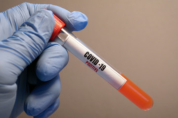 Obraz premium Coronavirus 2019-nCoV Blood Sample. Testing positive to covid-19. Corona Virus in Lab. Scientist hold tube with Blood Test with the Virus Name Coronavirus. Reaching europe, killing in Italy