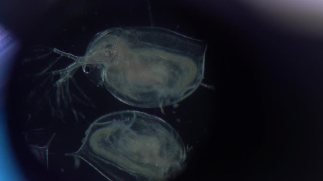 infusoria the shoe feeds by fingering the cilia under a microscope