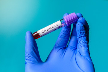 Obraz premium Positive blood test result for the new rapidly spreading Coronavirus, Blue edit space