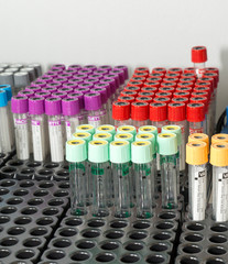 Tube for testing blood 